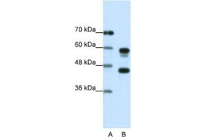 Western Blotting (WB) image for anti-Proteasome (Prosome, Macropain) 26S Subunit, ATPase, 5 (PSMC5) (C-Term) antibody (ABIN2780449)