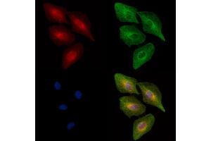 Phospho-MAP3K8/COT (Ser443) Antibody staining A549 cells(heat shock treatment) by IF/ICC. (MAP3K8 Antikörper  (pSer443))