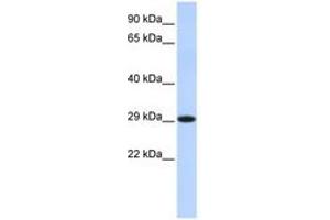 Image no. 1 for anti-Hydroxysteroid (17-Beta) Dehydrogenase 14 (HSD17B14) (C-Term) antibody (ABIN6741399) (HSD17B14 Antikörper  (C-Term))