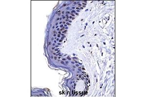 CSRP2 Antibody (Center) ((ABIN657989 and ABIN2846936))immunohistochemistry analysis in formalin fixed and paraffin embedded human skin tissue followed by peroxidase conjugation of the secondary antibody and DAB staining. (CSRP2 Antikörper  (AA 68-96))