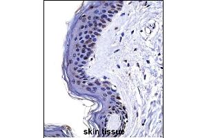 CSRP2 Antibody (Center) ((ABIN657989 and ABIN2846936))immunohistochemistry analysis in formalin fixed and paraffin embedded human skin tissue followed by peroxidase conjugation of the secondary antibody and DAB staining.
