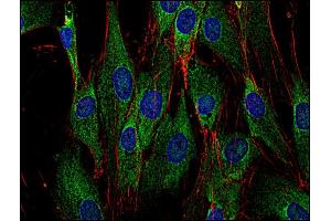 Immunocytochemistry staining of Sos in human primary fibroblasts using anti-Sos (SOS-01, green). (Sos Antikörper)