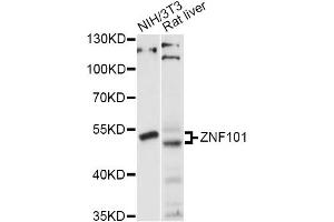 Western blot analysis of extracts of various cell lines, using ZNF101 antibody (ABIN6293896) at 1:1000 dilution.