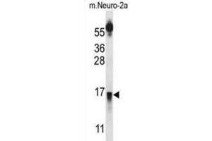 Western Blotting (WB) image for anti-Prolactin Releasing Hormone (PRLH) antibody (ABIN2997173) (PRLH Antikörper)