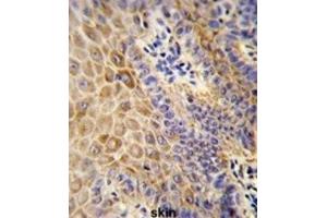 Immunohistochemistry (IHC) image for anti-Gc antibody (ABIN3003972) (Gc Antikörper)