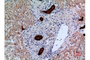 Immunohistochemistry (IHC) image for anti-Protein tyrosine Phosphatase, Receptor Type, J (PTPRJ) (Internal Region) antibody (ABIN6285228)
