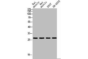Western blot analysis of RAT-MUSLE RAT-SPLEEN 293T SH-SY5Y using IL26 antibody. (IL-26 Antikörper  (Internal Region))