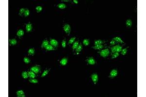 Immunofluorescent analysis of HepG2 cells using ABIN7143187 at dilution of 1:100 and Alexa Fluor 488-congugated AffiniPure Goat Anti-Rabbit IgG(H+L) (ACAD11 Antikörper  (AA 225-388))