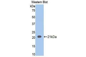 Western Blotting (WB) image for anti-Involucrin (IVL) (AA 6-156) antibody (ABIN1859461) (Involucrin Antikörper  (AA 6-156))