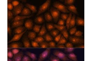 Immunofluorescence analysis of HeLa cells using DDX31 Polyclonal Antibody at dilution of 1:100. (DDX31 Antikörper)