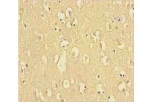 Immunohistochemistry of paraffin-embedded human brain tissue using ABIN7154647 at dilution of 1:100