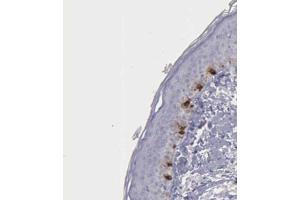 Immunohistochemical staining (Formalin-fixed paraffin-embedded sections) of human skin shows distinct cytoplasmic positivity in melanocytes with TYRP1 polyclonal antibody . (Tyrosinase-Related Protein 1 Antikörper  (AA 257-377))