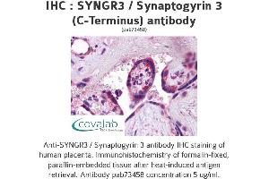 Image no. 1 for anti-Synaptogyrin 3 (SYNGR3) (C-Term) antibody (ABIN1739829)