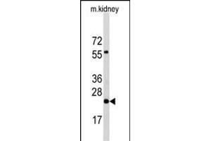 Western blot analysis of anti-PEMT Antibody (N-term) Pab (ABIN650614 and ABIN2844055) in mouse kidney tissue lysates (35 μg/lane). (PEMT Antikörper  (N-Term))
