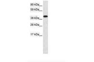 Image no. 1 for anti-Heat Shock 70kDa Protein 1A (HSPA1A) (AA 286-335) antibody (ABIN202621) (HSP70 1A Antikörper  (AA 286-335))