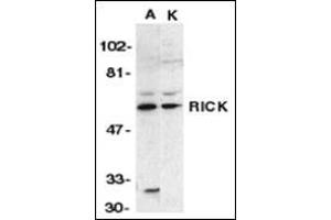 Western blot analysis of RICK in A431 (A) and K562 (K) whole cell lysate with this product at 1:1000 dilution.