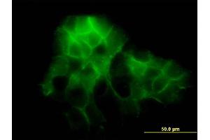 Immunofluorescence of monoclonal antibody to PCDH1 on A-431 cell. (Protocadherin 1 Antikörper  (AA 62-169))