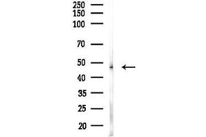 anti-Perilipin 3 (PLIN3) antibody