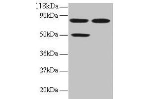 Western blot All lanes: CCL22 antibody at 2 μg/mL Lane 1: 293T whole cell lysate Lane 2: EC109 whole cell lysate Secondary Goat polyclonal to rabbit IgG at 1/15000 dilution Predicted band size: 11 kDa Observed band size: 50, 80 kDa (CCL22 Antikörper  (AA 25-82))
