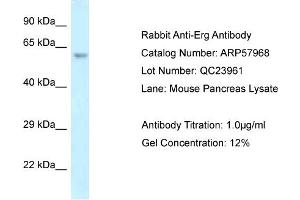 Western Blotting (WB) image for anti-ERG, ETS transcription factor (ERG) (C-Term) antibody (ABIN2787486) (ERG Antikörper  (C-Term))