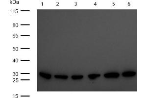 All lanes : C1QBP Rabbit mAb at 1/1k dilution Lane 1 : 3T3 whole cell lysates Lane 2 : Mouse Brain lysates Lane 3 : Mouse Kidney lysates Lane 4 : C6 whole cell lysates Lane 5 : Rat Brain lysates Lane 6 : Rat Kidney lysates Lysates/proteins at 20 μg per lane. (Rekombinanter C1QBP Antikörper)