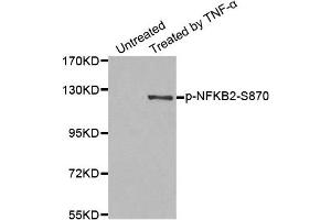 Western Blotting (WB) image for anti-Nuclear Factor of kappa Light Polypeptide Gene Enhancer in B-Cells 2 (NFKB2) (pSer870) antibody (ABIN1870475) (NFKB2 Antikörper  (pSer870))