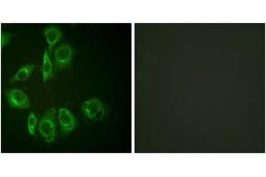 Immunofluorescence analysis of HuvEc cells, using PKC-pan (Ab-Thr497) Antibody. (PKC Antikörper  (Thr497))
