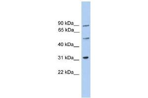 C6orf182 antibody used at 0. (CEP57L1 Antikörper  (Middle Region))
