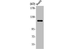 Western Blot analysis of Jurkat cells using SPT16 Polyclonal Antibody (SUPT16H Antikörper  (C-Term))
