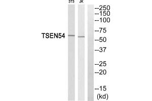 Western blot analysis of extracts from 3T3 cells and Jurkat cells, using TSEN54 antibody. (TSEN54 Antikörper  (Internal Region))