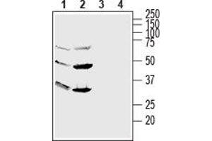 Western blot analysis of human HL-60 promyelocytic leukemia (lanes 1 and 3) and human NK-92 natural killer (lanes 2 and 4) cell line lysates: - 1,2. (GPR56 Antikörper  (Extracellular, N-Term))