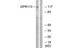 Western Blotting (WB) image for anti-G Protein-Coupled Receptor 113 (GPR113) (AA 21-70) antibody (ABIN2890837) (GPR113 Antikörper  (AA 21-70))
