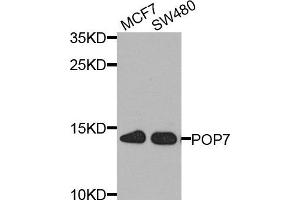 Western blot analysis of extract of MCF7 and SW480 cells, using POP7 antibody. (POP7 Antikörper)