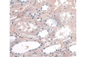 DAB staining on IHC-P; Samples: Human Kidney Tissue. (APOA1 Antikörper  (AA 122-267))