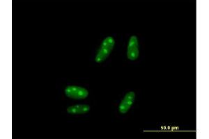 Immunofluorescence of purified MaxPab antibody to SSX5 on HepG2 cell.