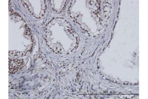 Immunoperoxidase of monoclonal antibody to ESPL1 on formalin-fixed paraffin-embedded human prostate. (Separase Antikörper  (AA 586-701))