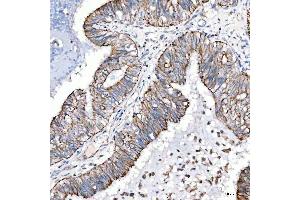 IHC analysis of Cytokeratin 4/KRT4 using anti-Cytokeratin 4/KRT4 antibody (ABIN7600283).