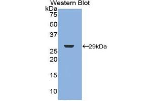 Western blot analysis of the recombinant protein. (Merlin Antikörper  (AA 30-239))