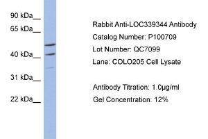 WB Suggested Anti-MYPOP  Antibody Titration: 0.