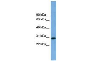 Image no. 1 for anti-Regulator of Calcineurin 2 (RCAN2) (AA 71-120) antibody (ABIN6746341)