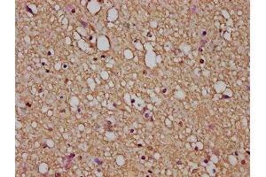 IHC image of ABIN7153853 diluted at 1:200 and staining in paraffin-embedded human brain tissue performed on a Leica BondTM system. (GFAP Antikörper  (AA 292-432))
