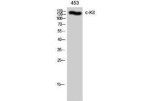 Western Blotting (WB) image for anti-Mast/stem Cell Growth Factor Receptor (KIT) (Ser71) antibody (ABIN3183926) (KIT Antikörper  (Ser71))