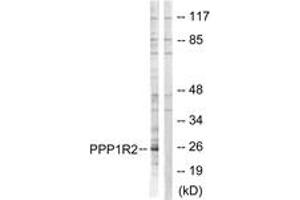 Western blot analysis of extracts from Jurkat cells, using PPP1R2 (Ab-120/121) Antibody.