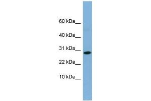 WB Suggested Anti-RPE Antibody Titration: 0. (RPE Antikörper  (Middle Region))