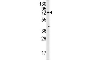 Western blot analysis of Rex1 antibody and mouse lung tissue lysate (ZFP42 Antikörper  (AA 1-30))