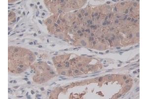 Detection of RALA in Human Stomach Tissue using Monoclonal Antibody to V-Ral Simian Leukemia Viral Oncogene Homolog A (RALA) (rala Antikörper  (AA 1-206))