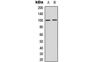 Western blot analysis of NF-kappaB p100 (pS865) expression in HeLa (A), MCF7 (B) whole cell lysates. (NFKB2 Antikörper  (C-Term, pSer865))