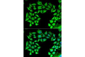 Immunofluorescence analysis of U2OS cells using TIMP4 antibody (ABIN5973817). (TIMP4 Antikörper)