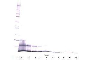 Image no. 1 for anti-Chemokine (C-C Motif) Ligand 5 (CCL5) antibody (ABIN465753) (CCL5 Antikörper)