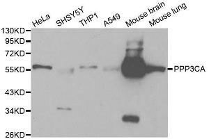 Western blot analysis of extracts of various cell lines, using PPP3CA antibody. (PPP3CA Antikörper  (AA 1-511))